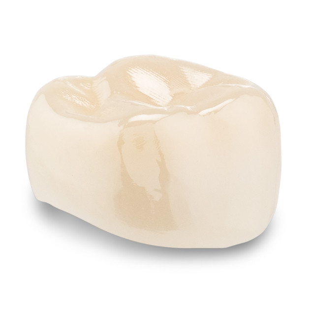 Acero Zirconia Crown Z1 J4 - Upper left primary second molar size 4 (pack of 1 crown), E-UL-4
