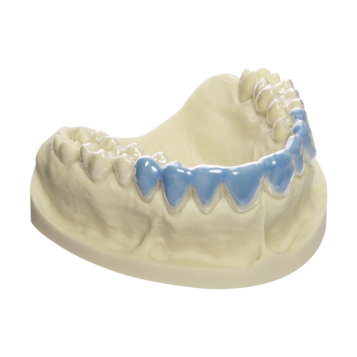 Dreve BioBleach Hard, thermoforming blank made of PETG especially developed for bleaching, 125 x 0.5 mm / 25 pieces clear-transparent - D420015S